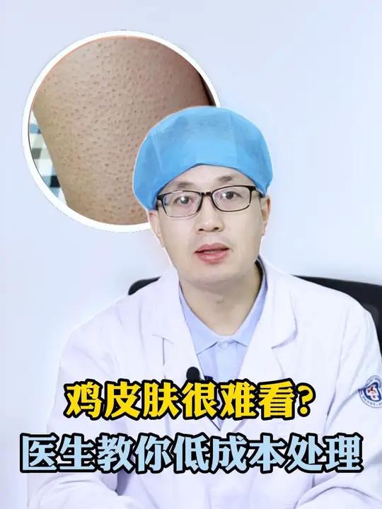你看过高清镜头下的鸡皮肤吗?千万别去抠哦!记住这个低成本的处理方法,很简单哒~鸡皮肤鸡皮疙