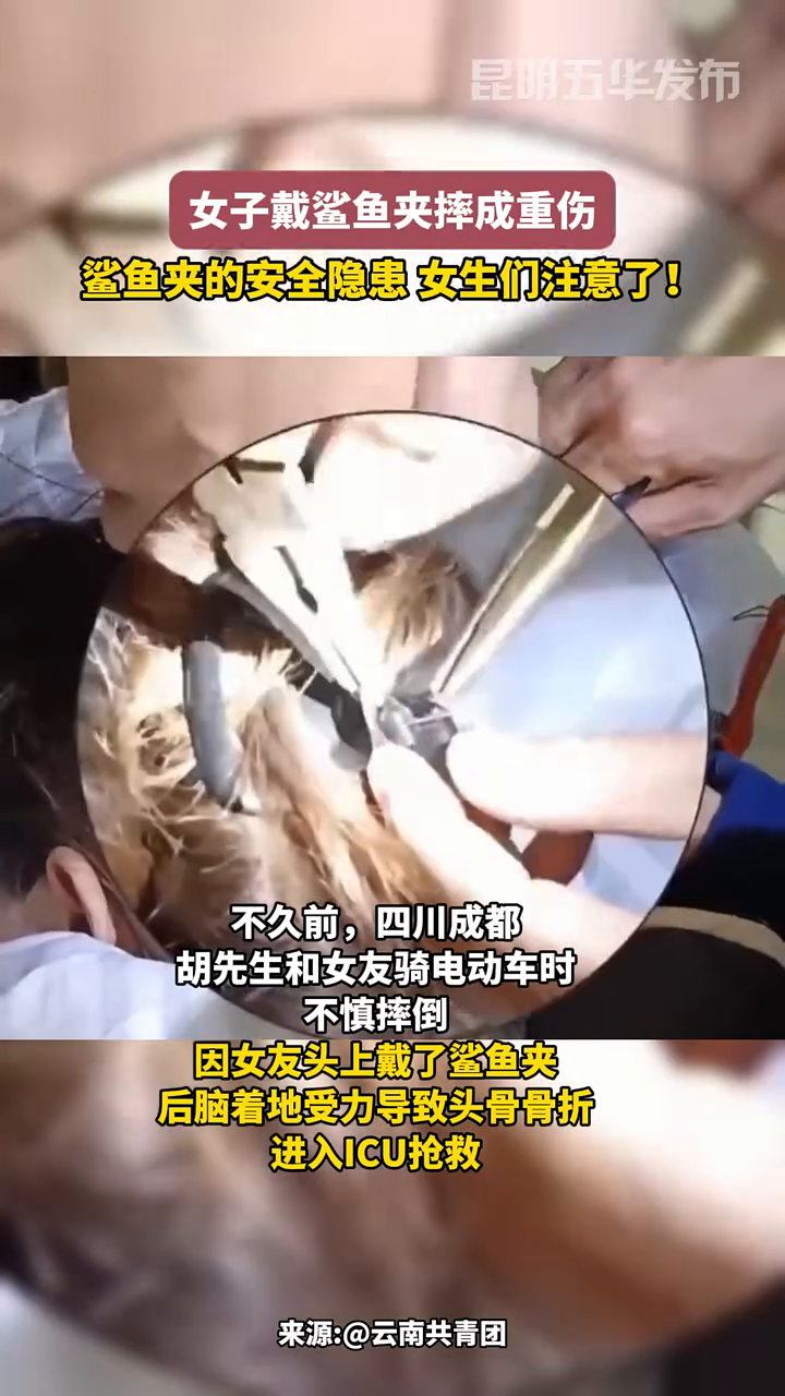 女子戴鲨鱼夹摔成重伤,鲨鱼夹的安全隐患,女生们注意了