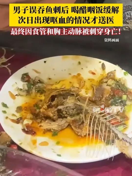 29岁男子误吞鱼刺后,通过喝醋和咽饭缓解,第二天出现呕血的情况才送医,最终因食管和胸主动脉