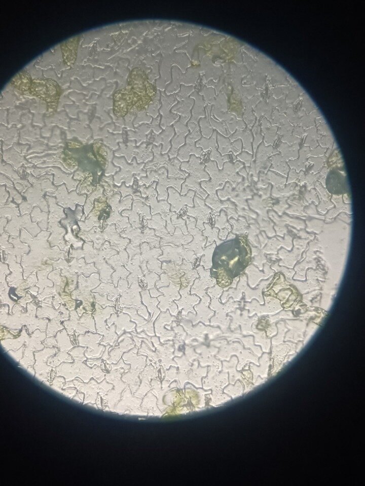 菠菜叶片下表皮细胞