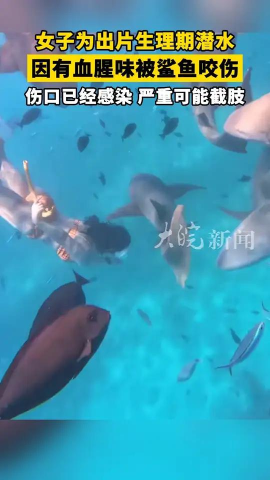 女子为出片生理期潜水因有血腥味被鲨鱼咬伤 伤口已经感染 严重可能截肢
