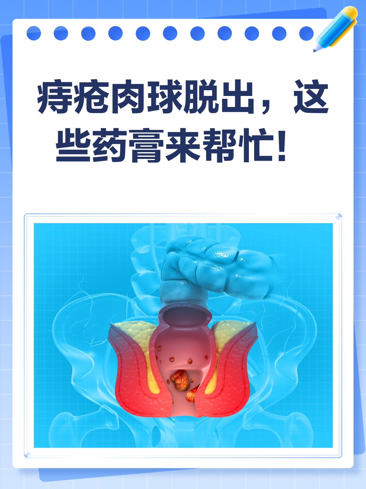 痔疮肉球脱出?这些药膏能帮你收回去!