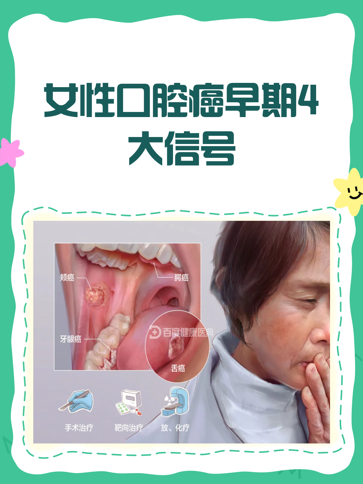 口腔癌早期信号女性必看!