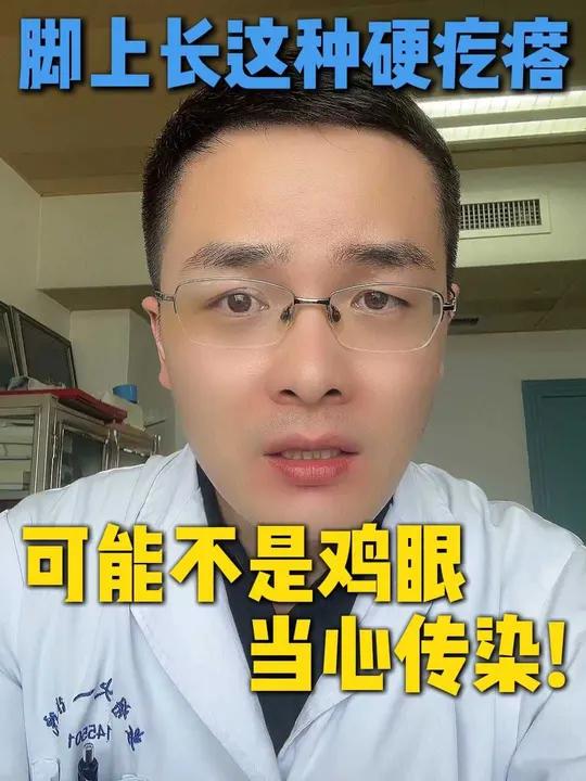 脚上长这种硬疙瘩，可能不是鸡眼，当心传染！