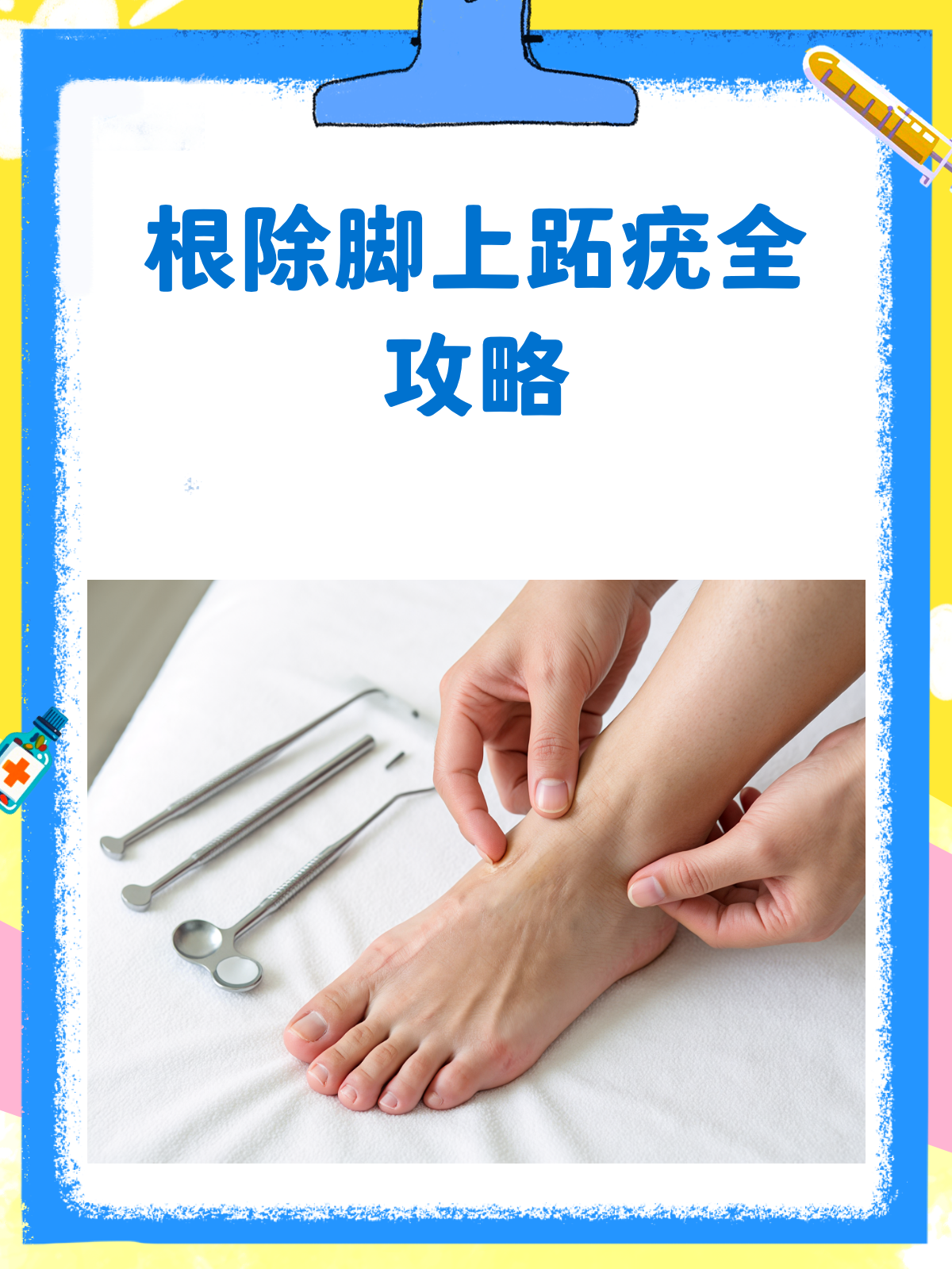 脚上跖疣,告别烦恼有妙招!