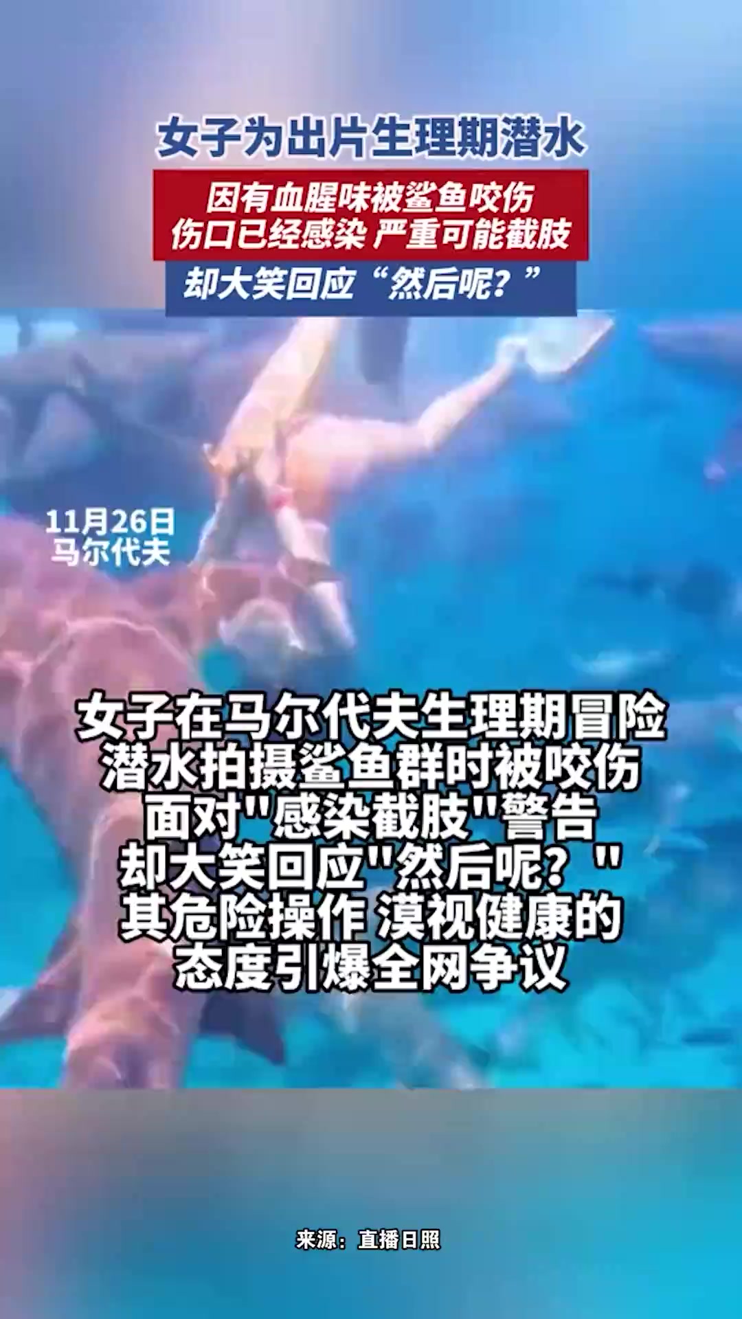 女子生理期在马尔代夫潜水拍摄鲨鱼群时被咬伤,面对“感染截肢”警告却大笑:然后呢