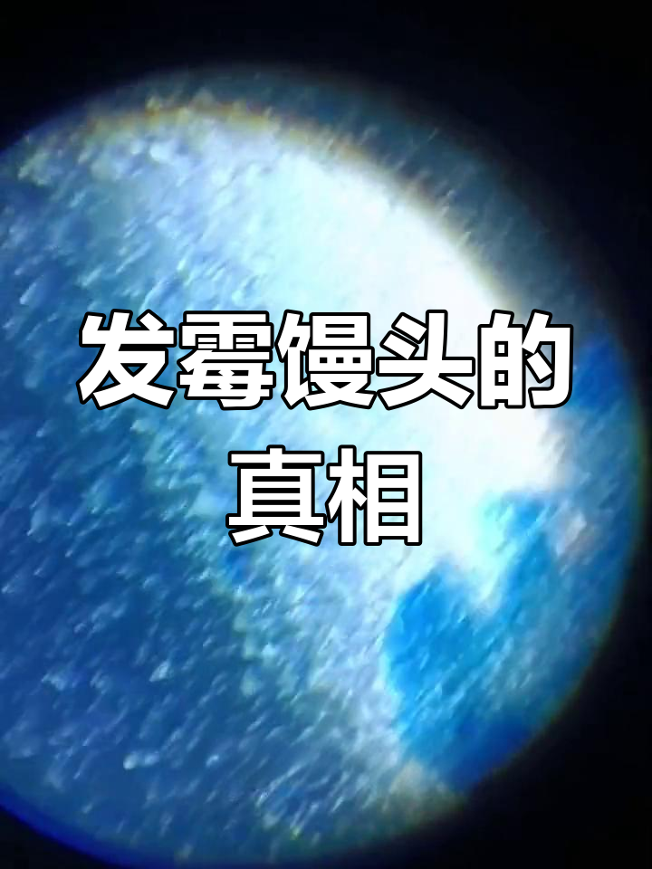 馒头发霉后还能吃吗?显微镜揭秘
