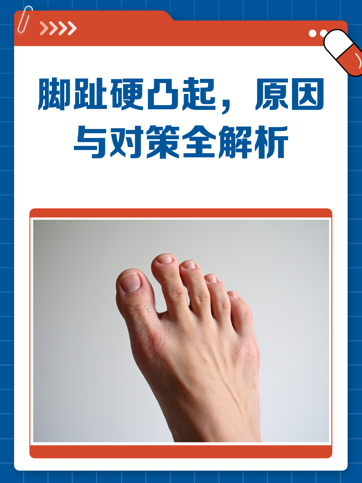 脚趾头上的硬凸起是啥?别急,这就揭秘