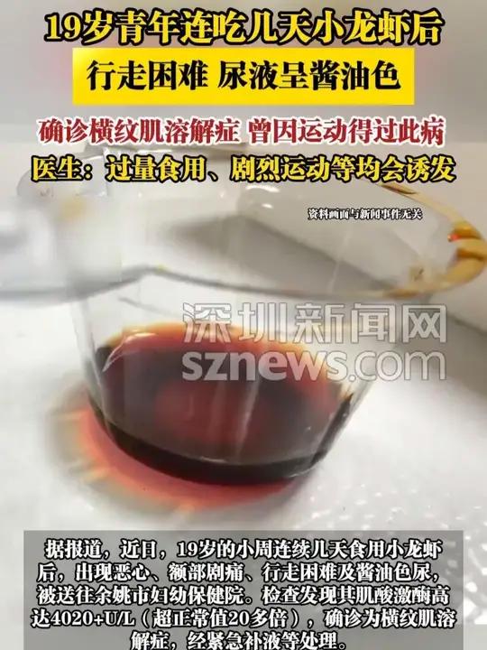 「19岁青年连吃几天小龙虾后,行走困难、尿液呈酱油色」确诊横纹肌溶解症,曾因运动得过此病