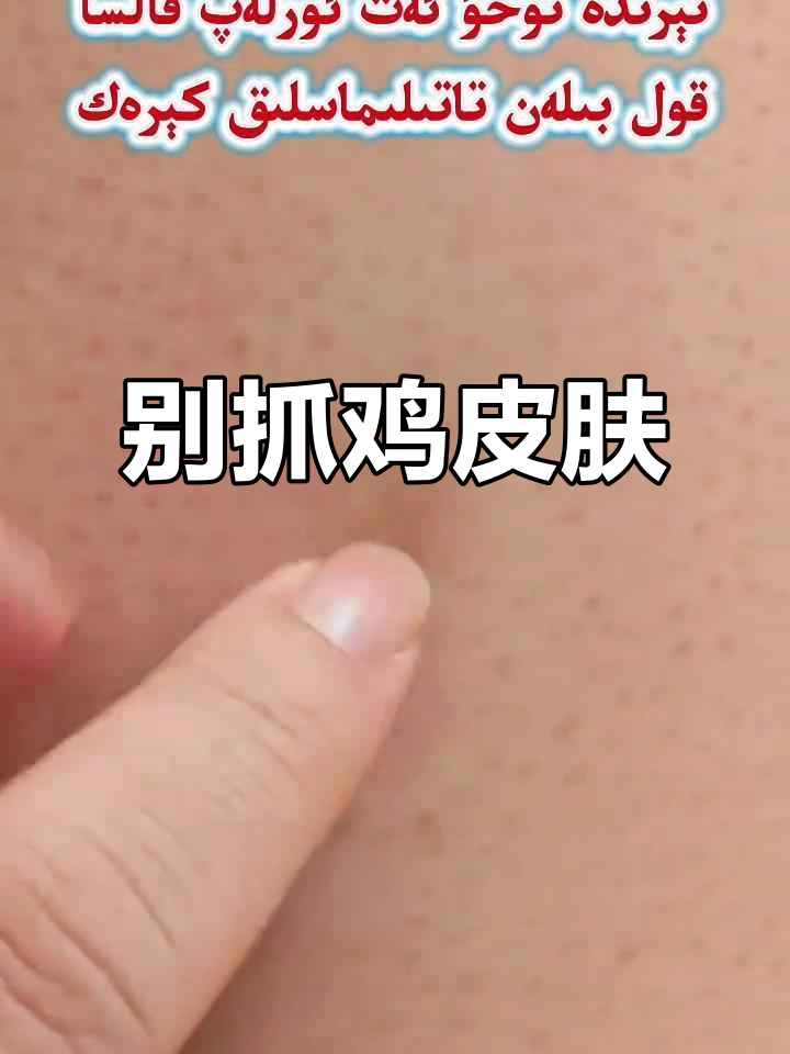 鸡皮肤痒?别用手挠,试试这些方法缓解症状