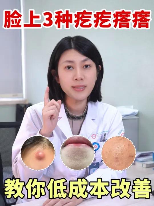 脸上常见的疙疙瘩瘩,一条视频讲清楚!