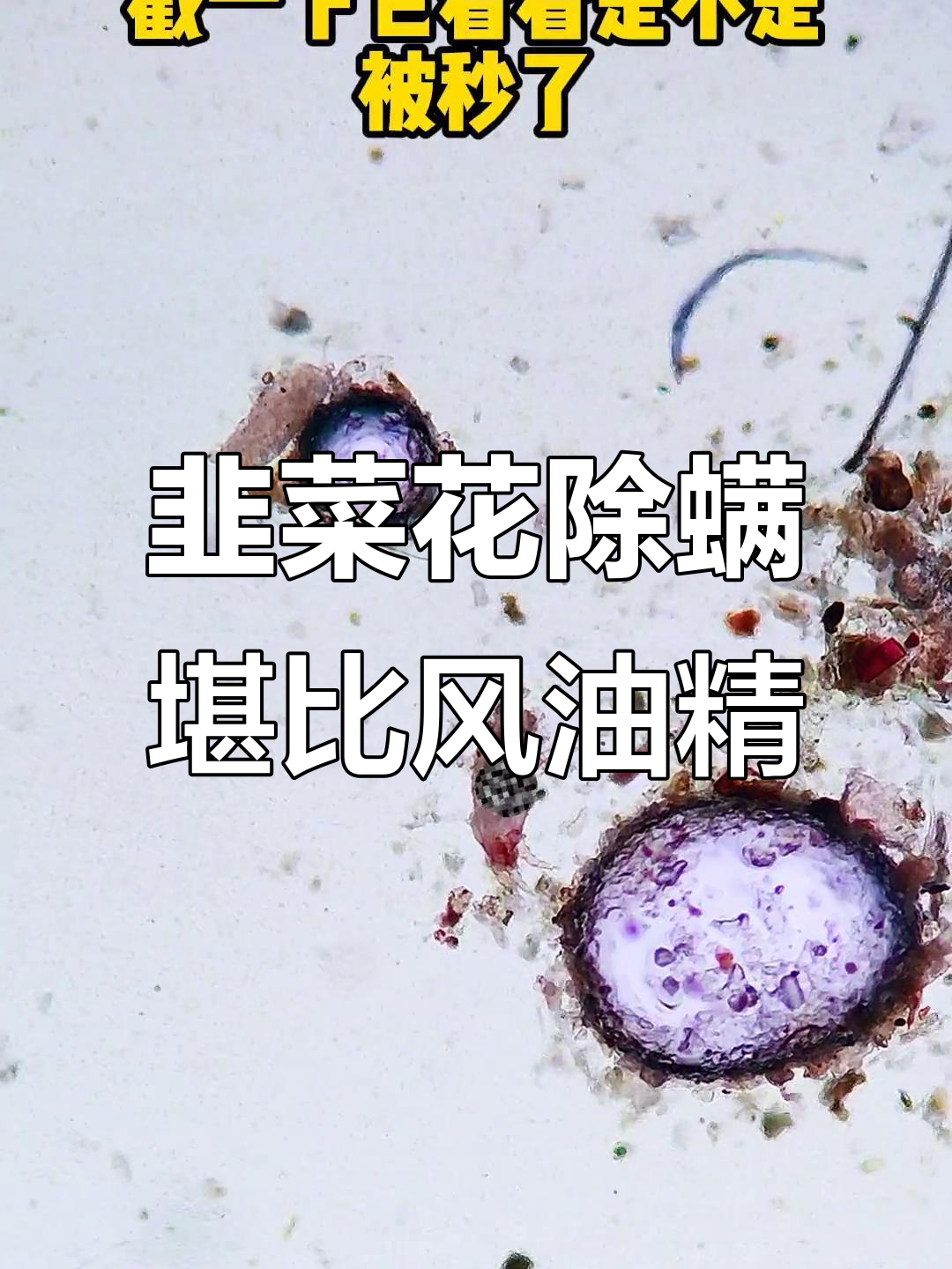 韭菜花竟能替代风油精,除螨效果惊人!