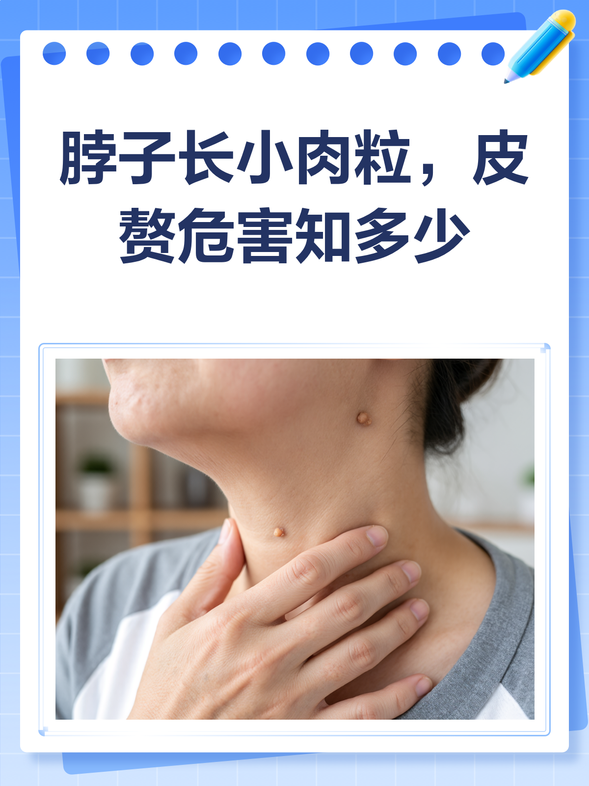 脖子长小肉粒别忽视!可能是皮赘,这些危害你要知道!