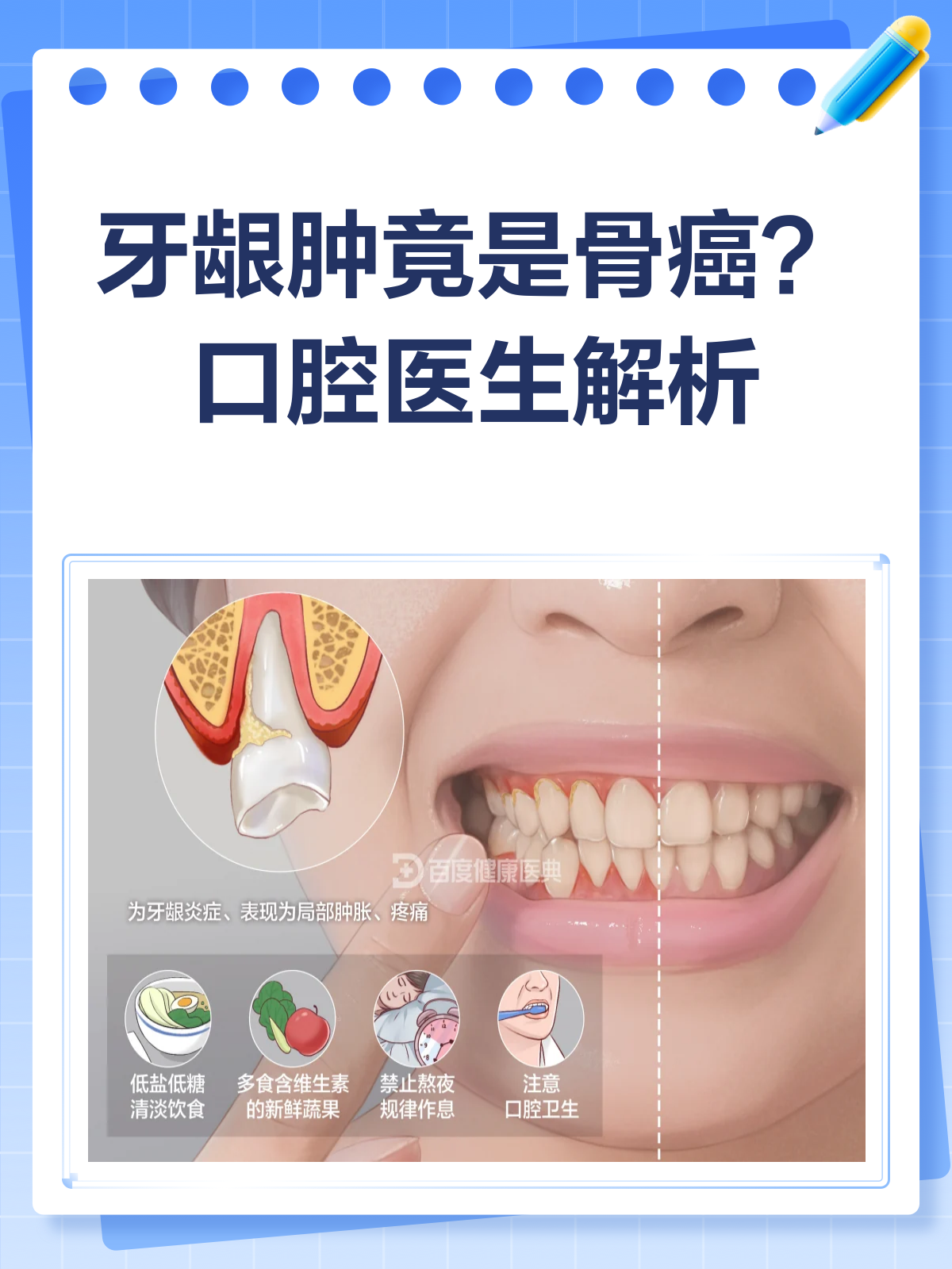 牙龈肿成核桃,竟是骨癌预警?口腔医生揭秘!