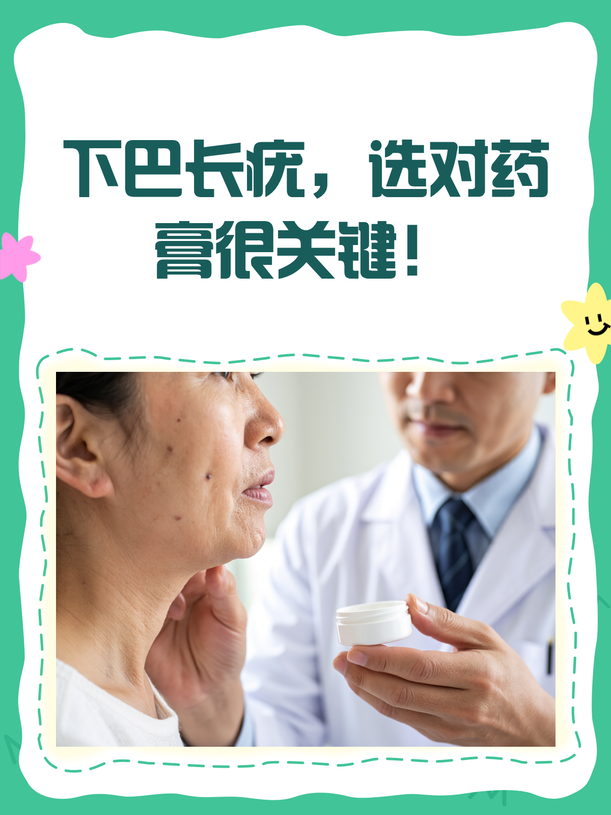 下巴长疣别烦恼,选对药膏很重要!