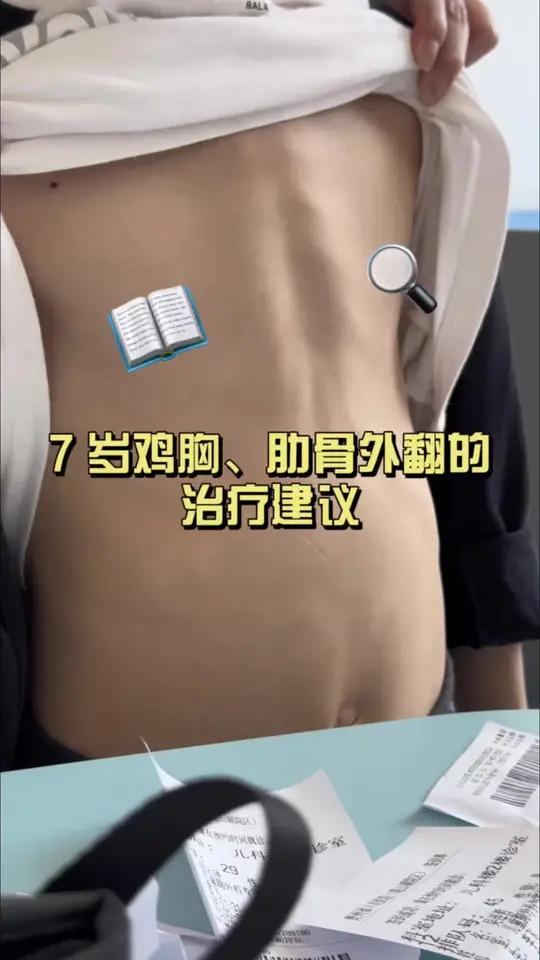 7 岁鸡胸、肋骨外翻的治疗建议