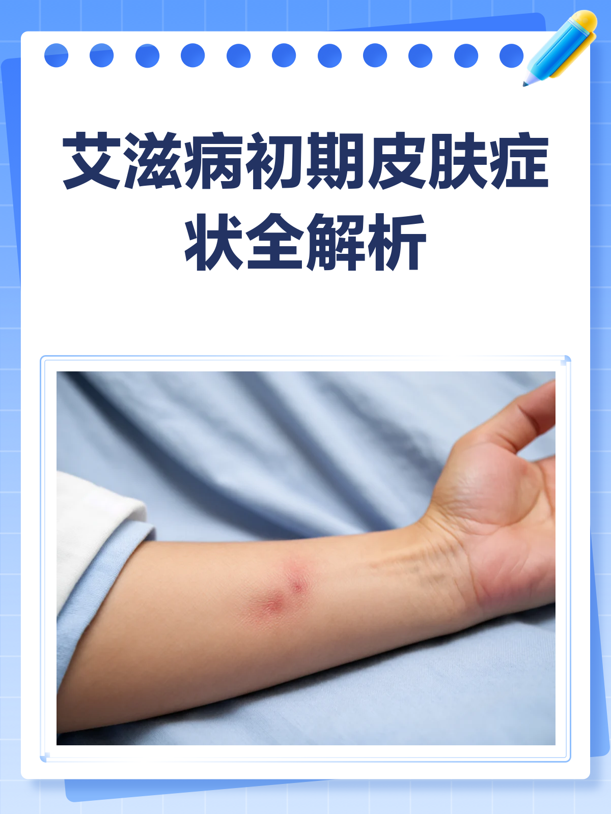 艾滋病初期,皮肤会给你哪些“警告”?