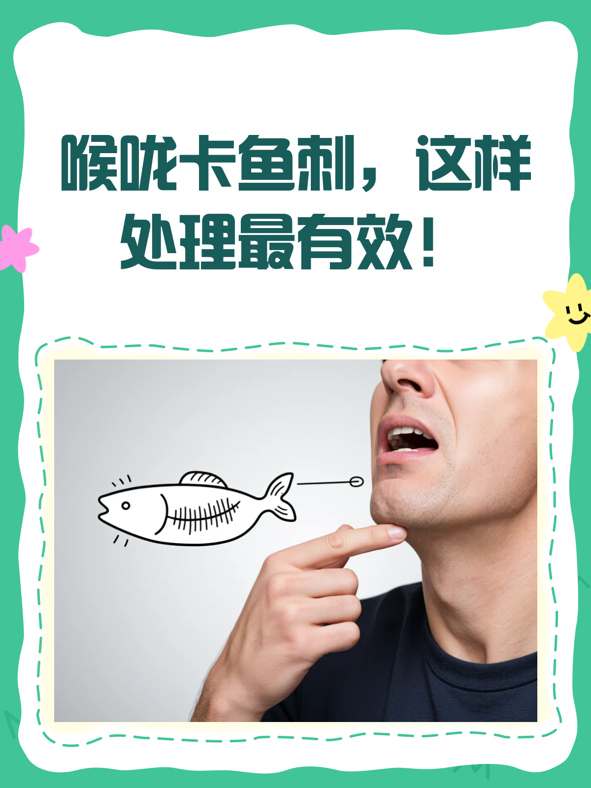 鱼刺卡喉怎么办?小妙招与最佳处理法来啦!