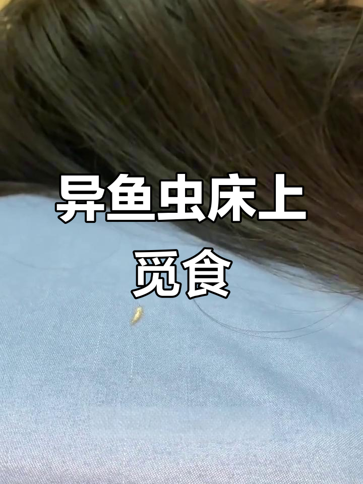 异鱼虫爬床吃头发,警惕家中隐患