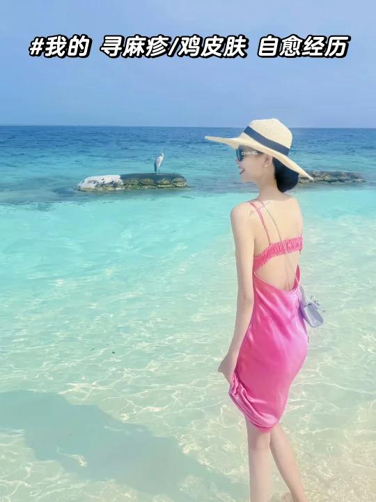 讲个真事,我的寻麻疹/鸡皮肤自愈方法(无广)