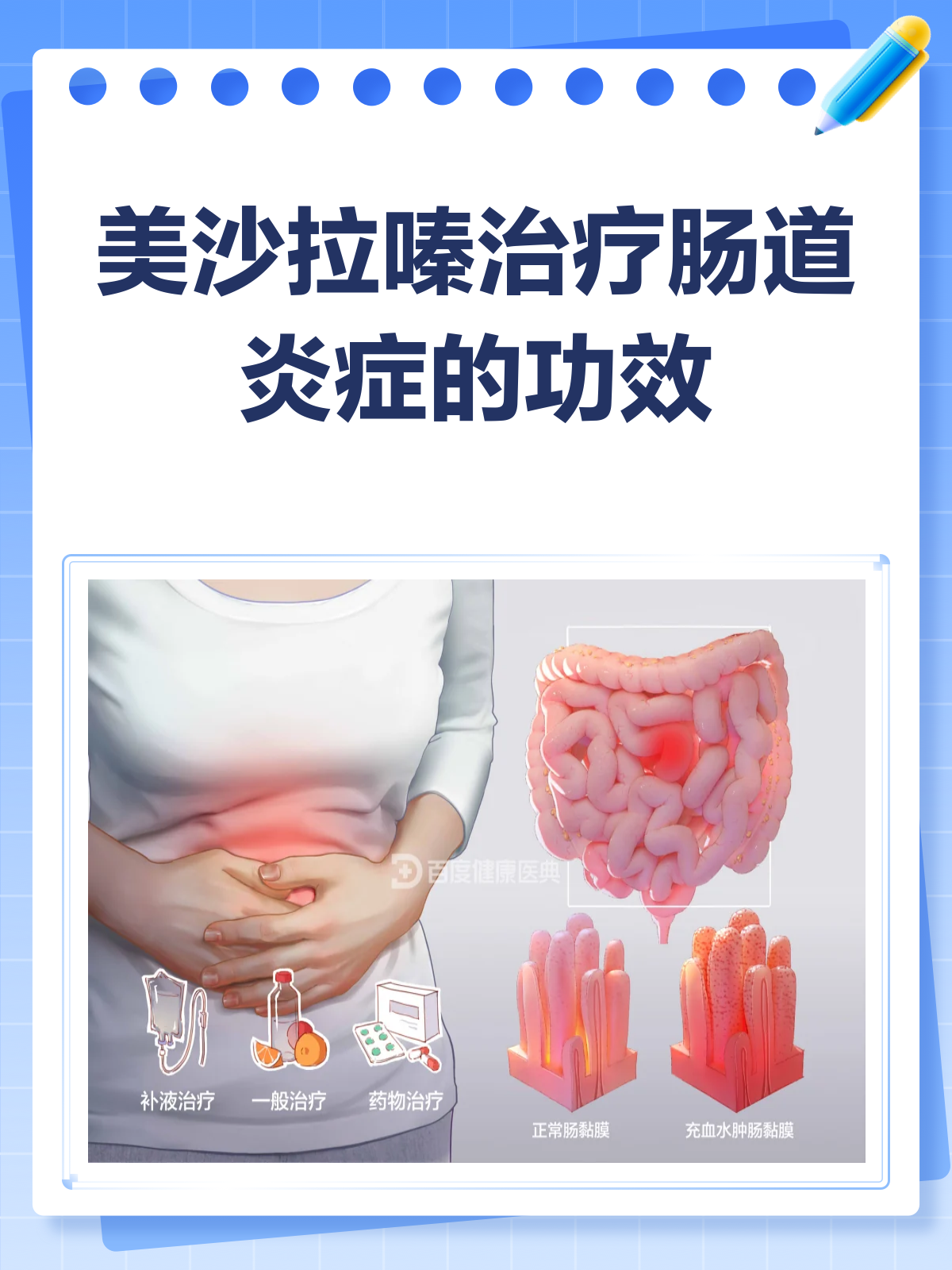 美沙拉嗪,肠道炎症的“灭火器”