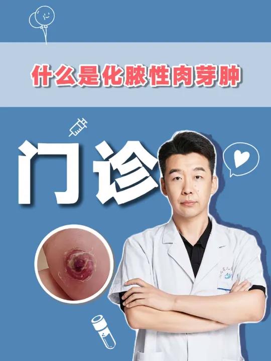 最近很多家长朋友问我:什么样的才是化脓性的肉芽肿?化脓性肉芽肿有什么特点呢?今天就为大家解