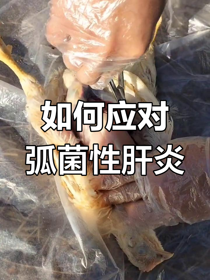 弧菌性肝炎的治疗方案