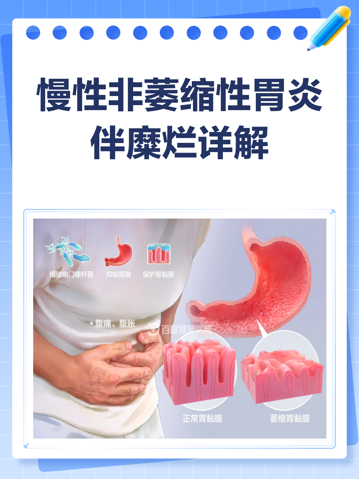 慢性非萎缩性胃炎伴糜烂,真的严重吗?