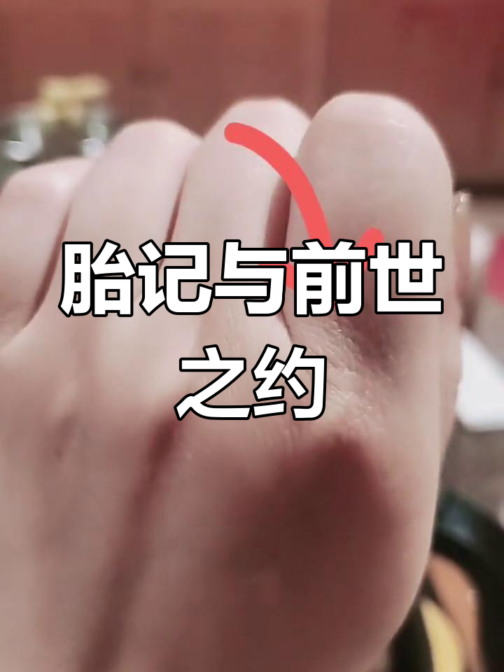 手上的鱼鳞痣,是上辈子的承诺