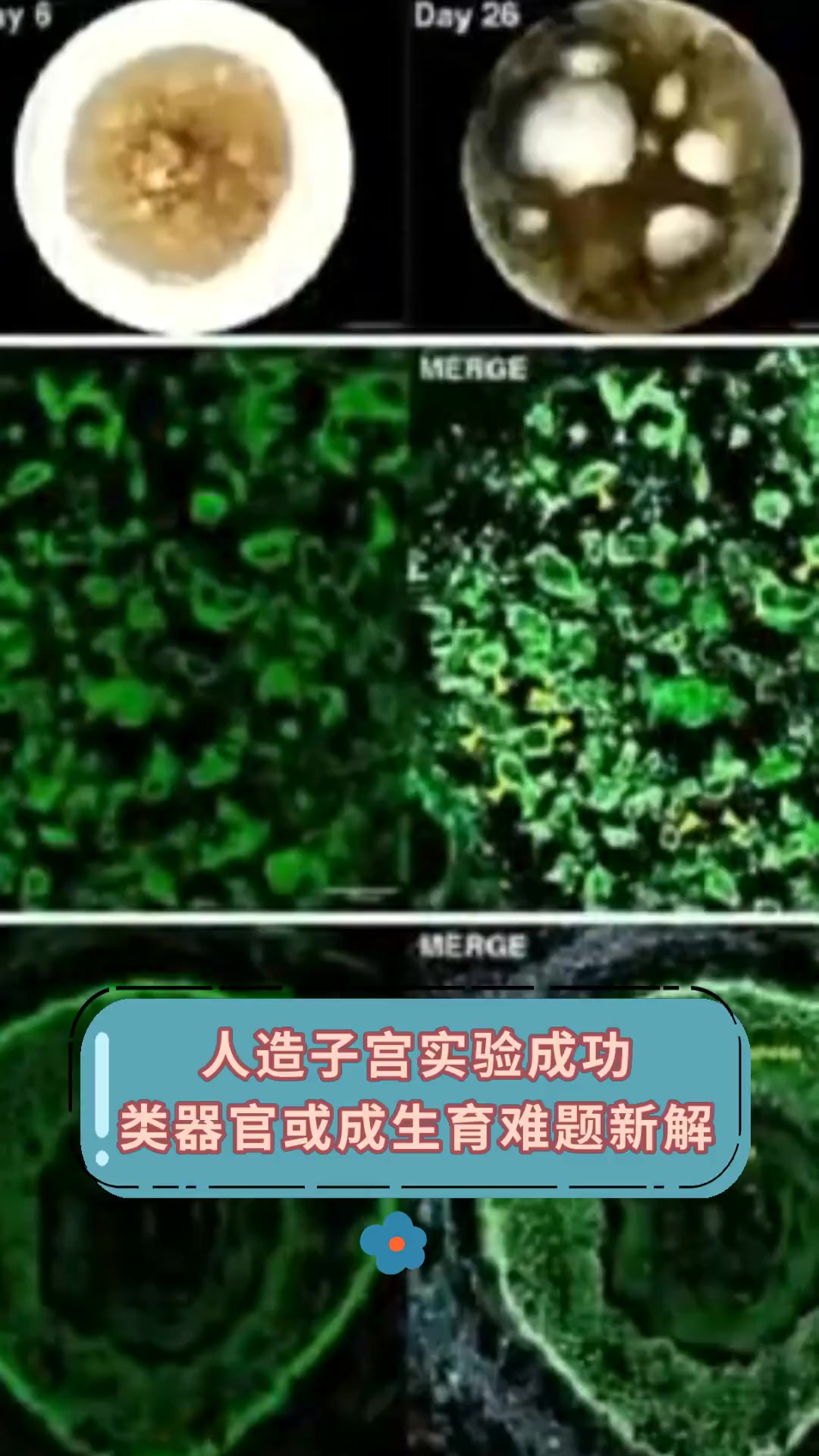 人造子宫实验成功,类器官或成生育难题新解