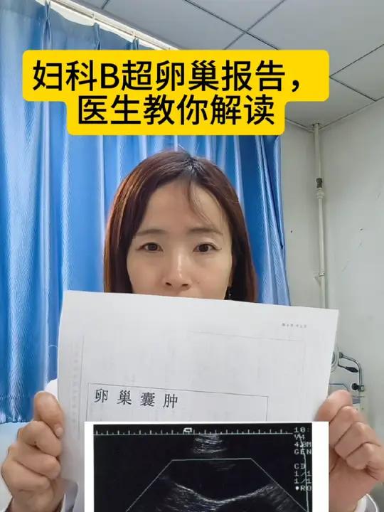妇科B超卵巢报告,卵巢囊肿、巧克力囊肿……医生教你解读!妇科B超卵巢报告,卵巢囊肿、巧克力