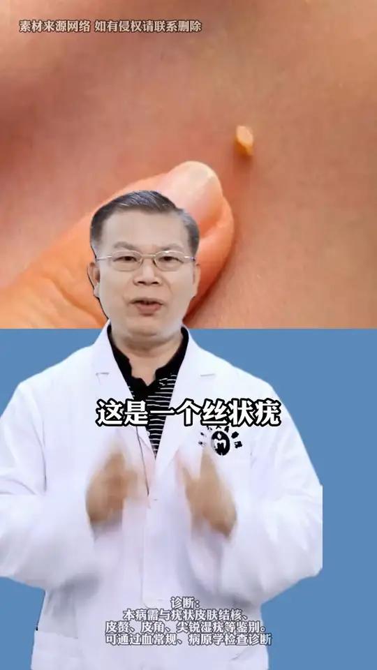 脖子,眼睑长小肉丝,不要揪!看完视频你就知道怎么处理了