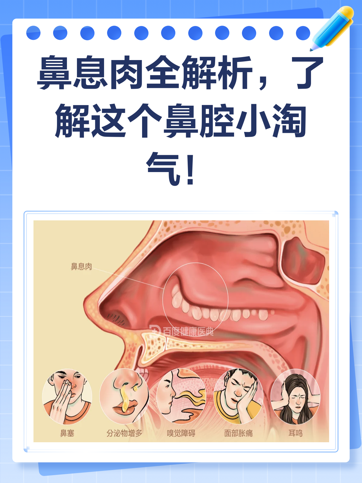 鼻息肉知多少?揭秘鼻腔里的“不速之客”!