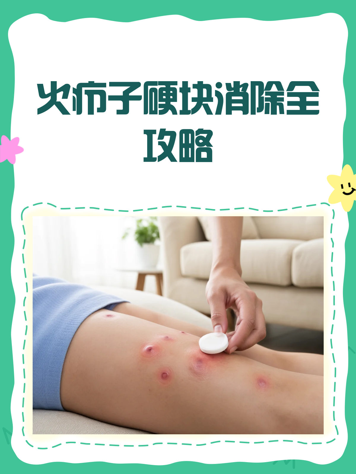 火疖子硬块消除秘籍,告别烦恼就靠它!