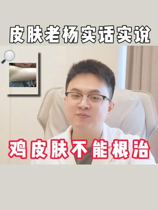 让人苦恼的鸡皮肤能根治吗?毛周角化
