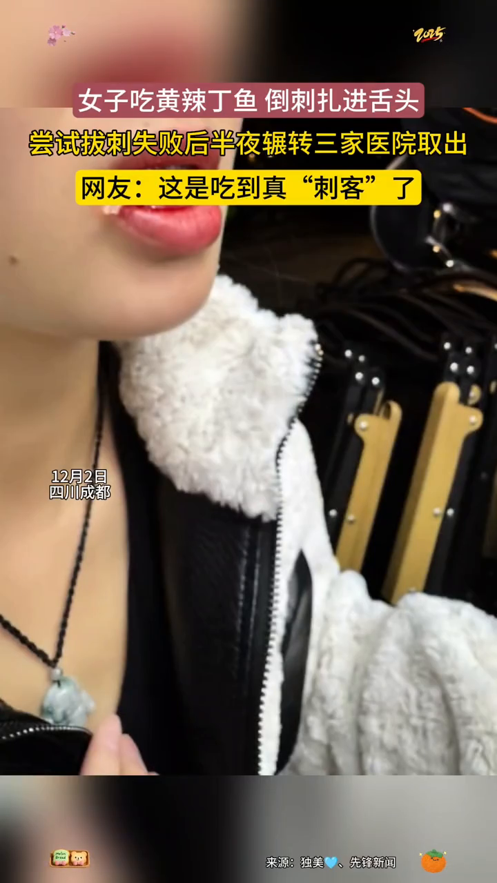 女子被4cm鱼刺卡舌连跑3家医院,黄辣丁才是真的火锅刺客