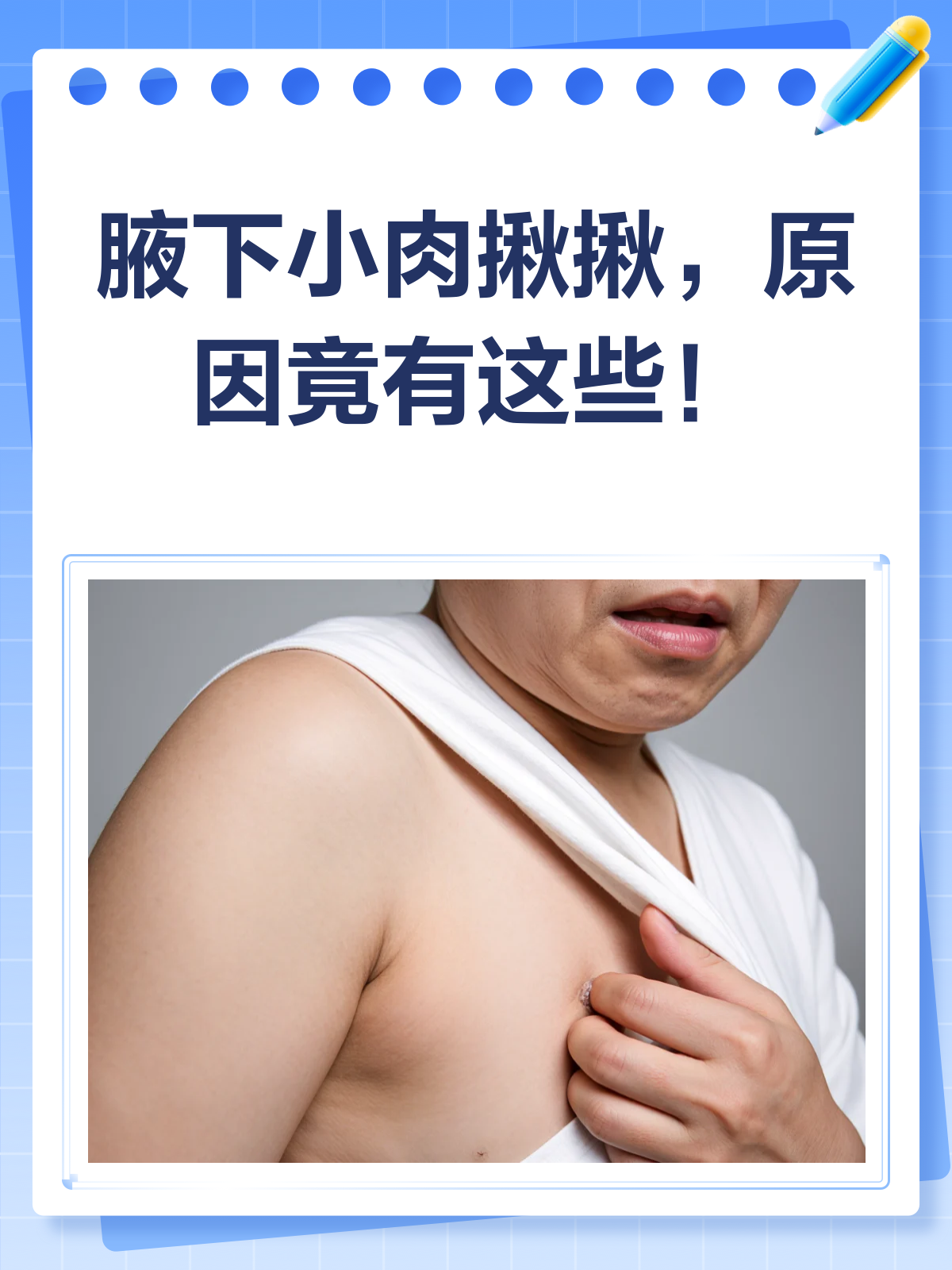 腋下小肉揪揪?别慌,一文告诉你咋回事!