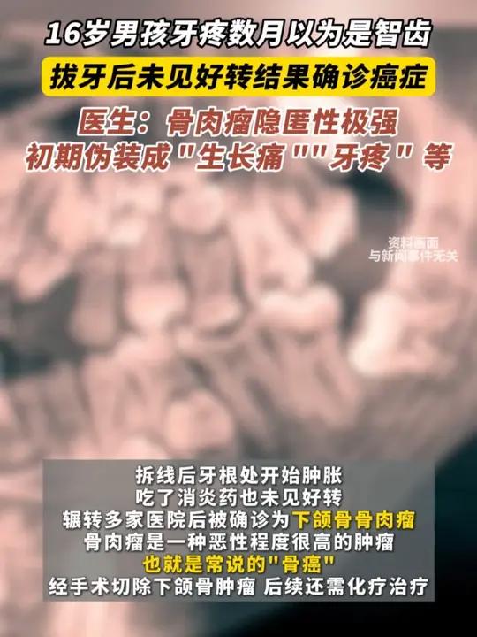 16岁男孩牙疼数月以为是智齿 拔牙后未见好转结果确诊癌症 医生:骨肉瘤隐匿性极强 初期伪装