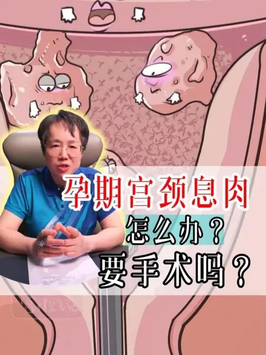 孕期宫颈息肉怎么办?
