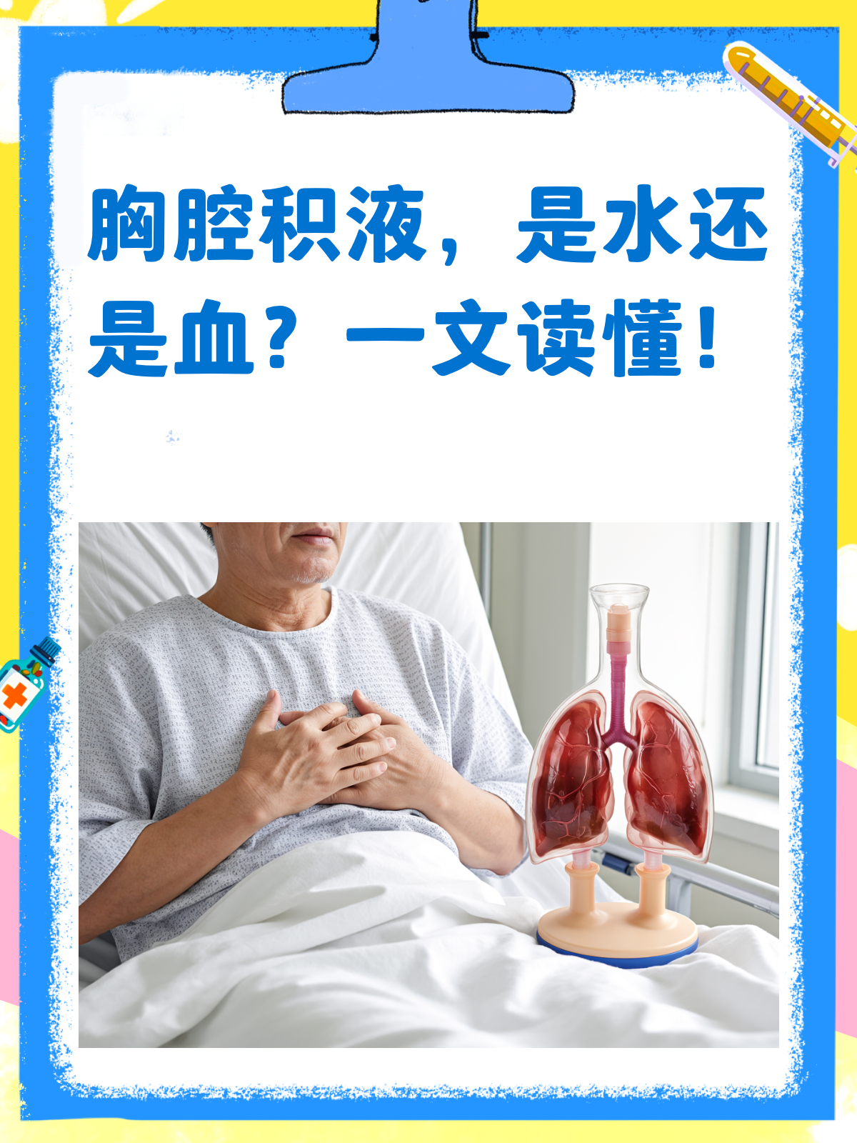 胸腔积液,是水还是血?一文给你讲明白!