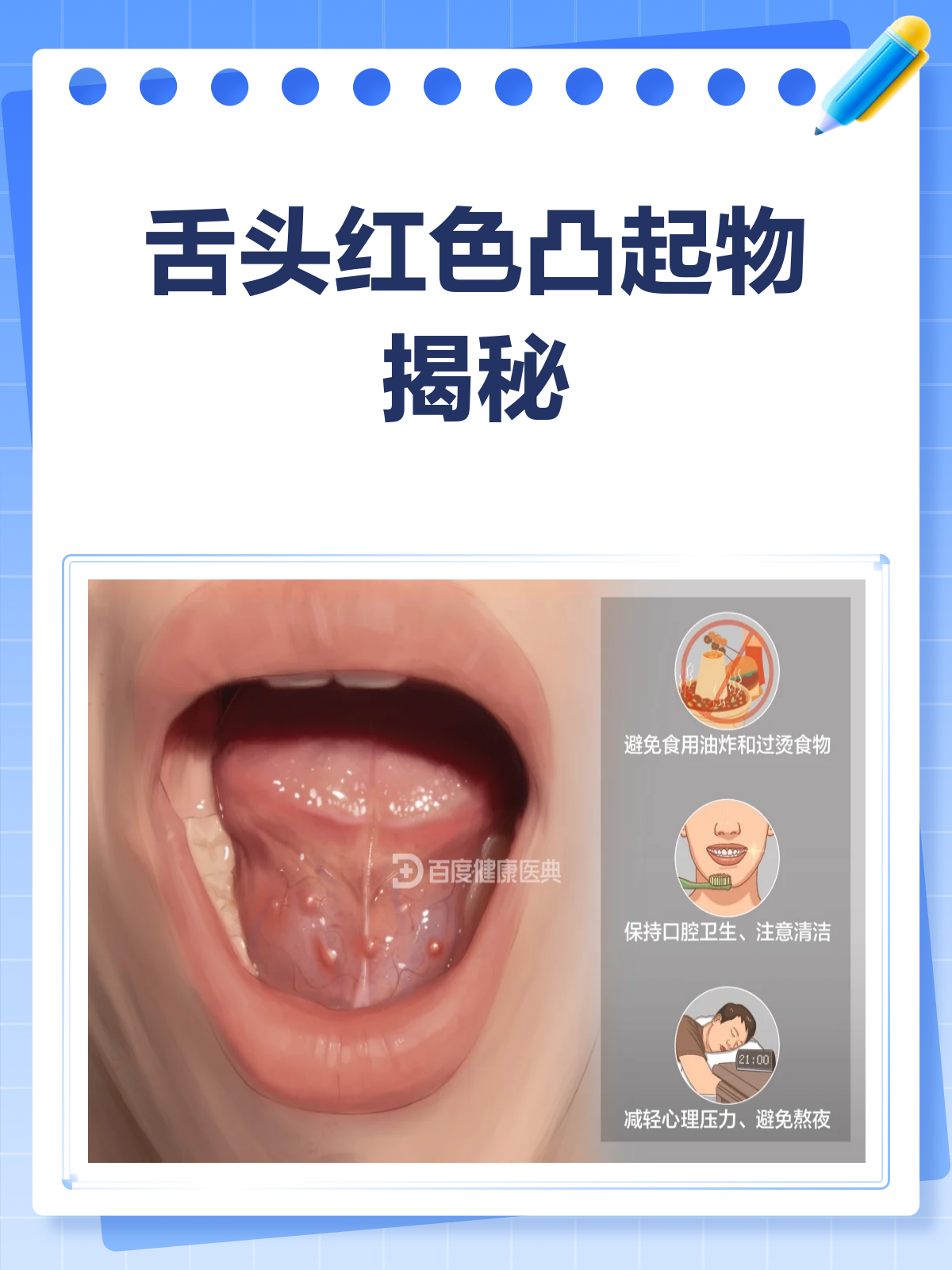 舌头上长红疙瘩？别急，先看看这篇！