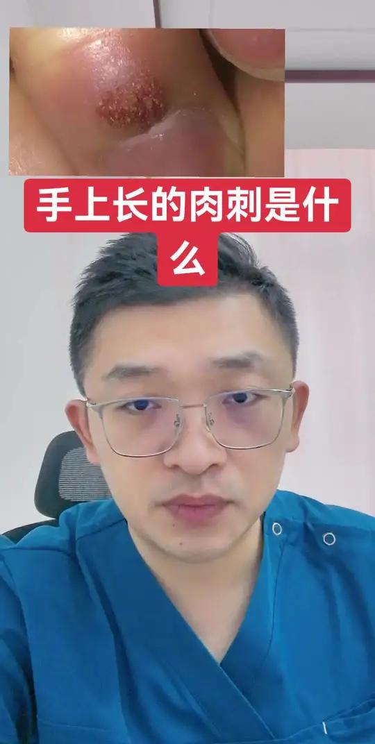 手上长的肉刺是什么