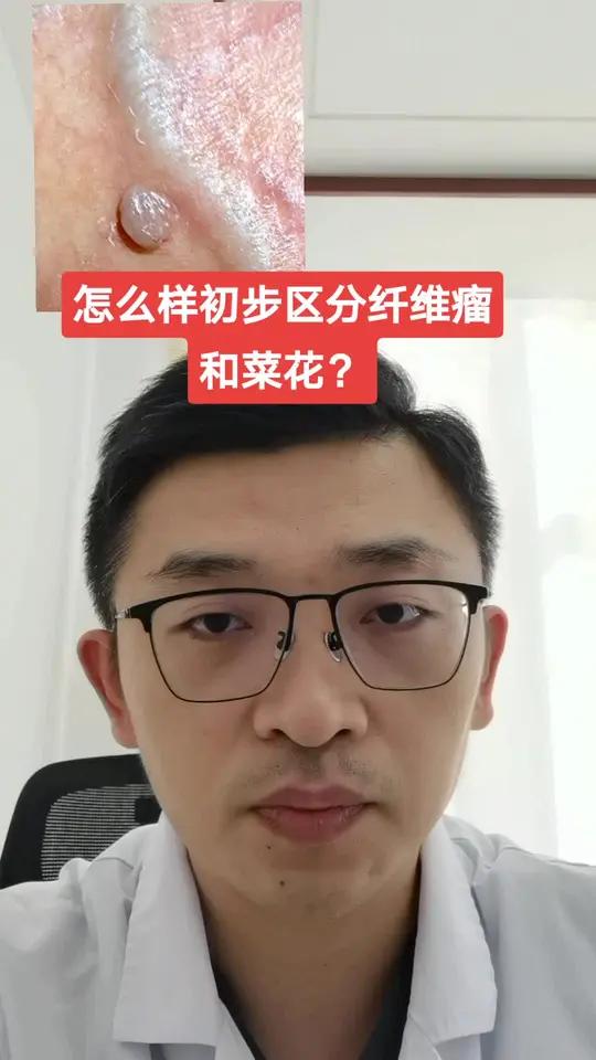 怎么样初步区分纤维瘤和菜花样改变