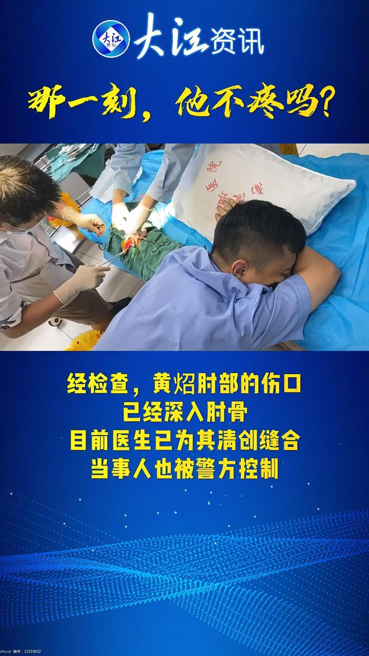 许镇派出所民警黄炤,调解一起家庭纠纷时,为制止当事人过激行为,肘部被砍伤,鲜血喷洒一地。真