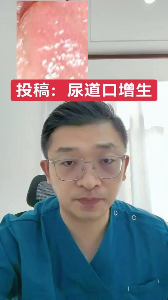 投稿：尿道口增生 