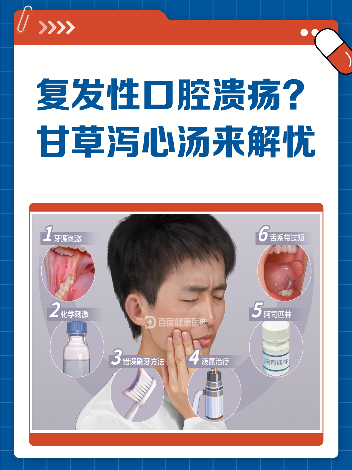 复发性口腔溃疡？试试甘草泻心汤！