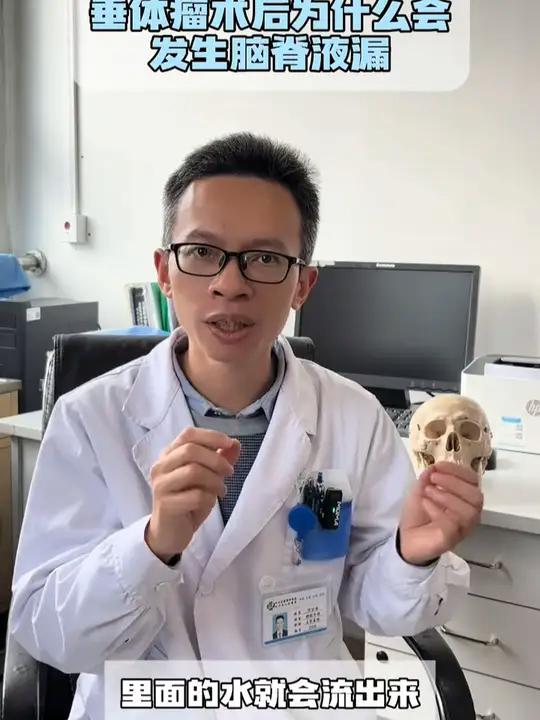 垂体瘤术后为什么会发生脑脊液鼻漏 首先是垂体瘤生长本身对于颅底骨质的破坏,其次在我们在进行
