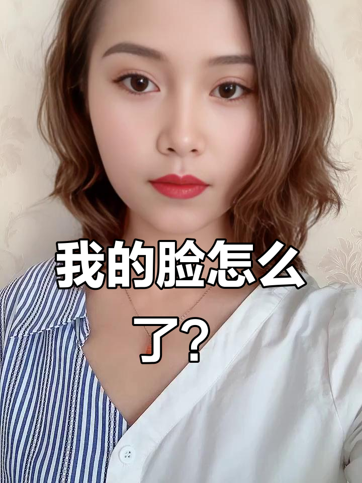 眼睛肿成鱼泡,鼻子也不对劲了!医生说我需要个王子吻才能恢复