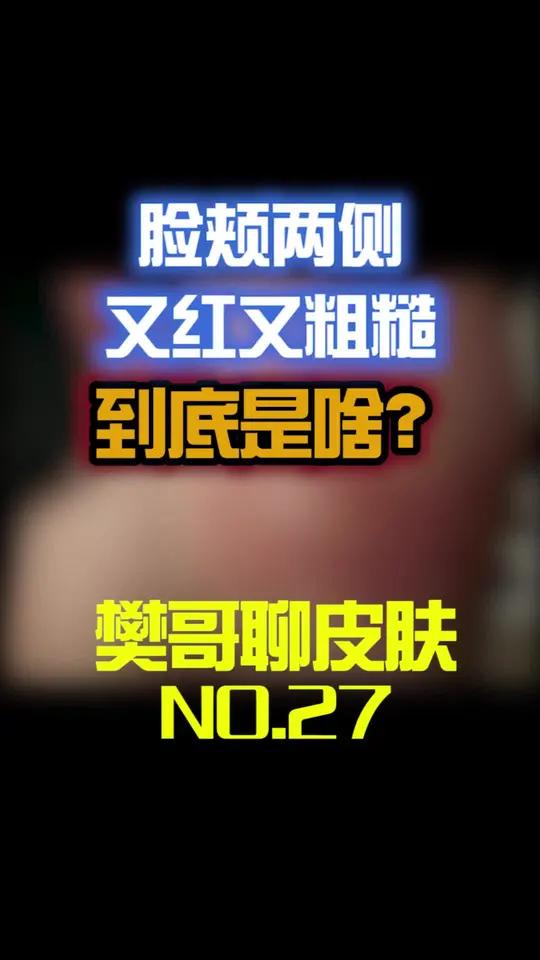 脸上红红粗糙,不单单是鸡皮肤,这么办!