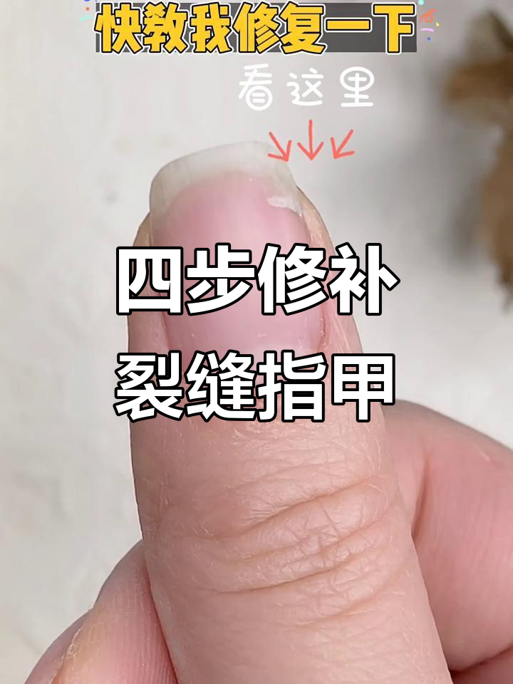 指甲裂开怎么办?简单四步修复残甲,告别疼痛